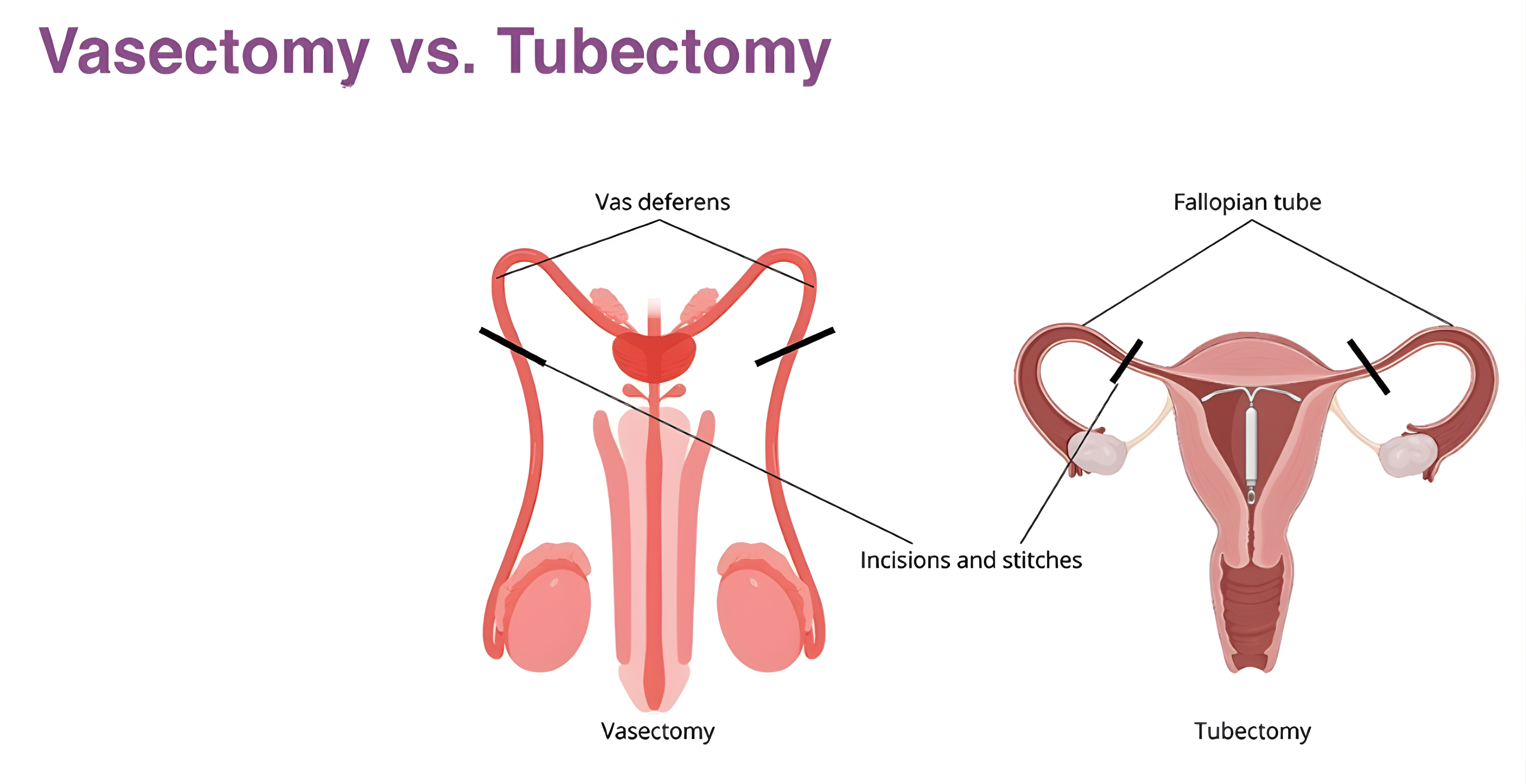 Dr. MD. Sabir Pasha - Family Planning Surgery Specialist